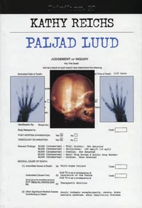 Paljad luud