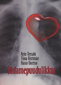 Südamepuudulikkus