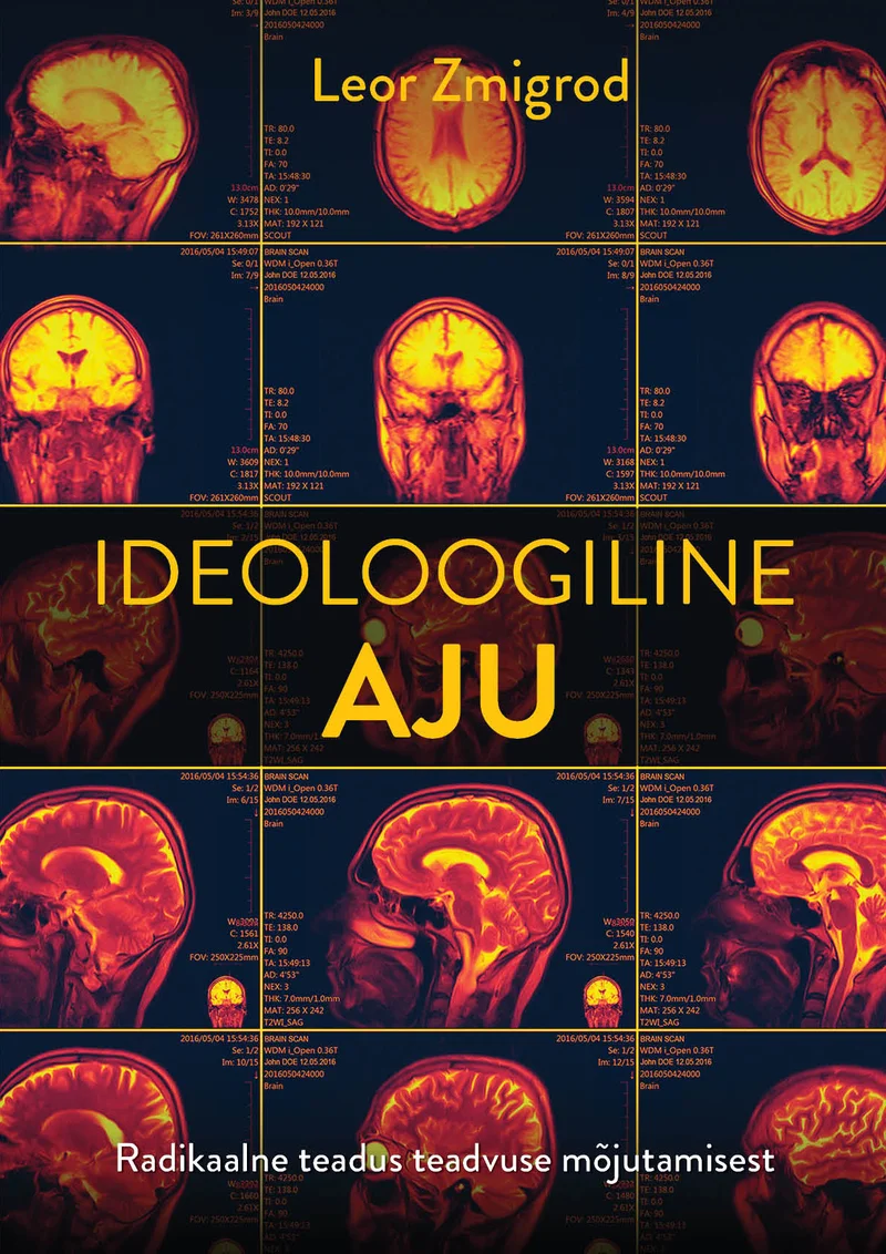 Ideoloogiline aju - Leor Zmigrod (2026). Tumeda taustaga kaanel domineerivad soojades punase, oranži ja kollase toonides MRI-skaneeringute pildid inimese ajust, mis on paigutatud ruudustikuna. Kujundus annab teaduslik-meditsiinilise mulje.