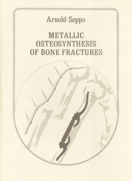 Metallic osteosynthesis of bone fractures based on the topography of bone resistance